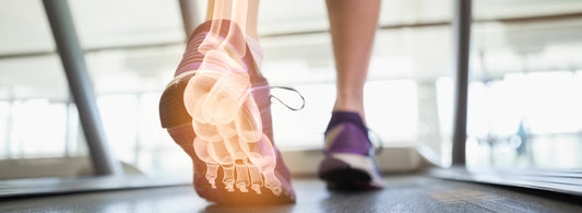 Stukad fot rehab och träningsschema